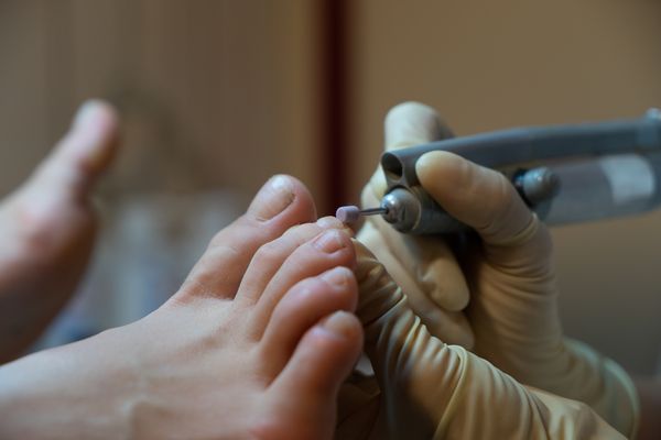 medizinische Fußpflege 